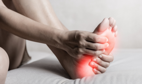 plantar fasciitis